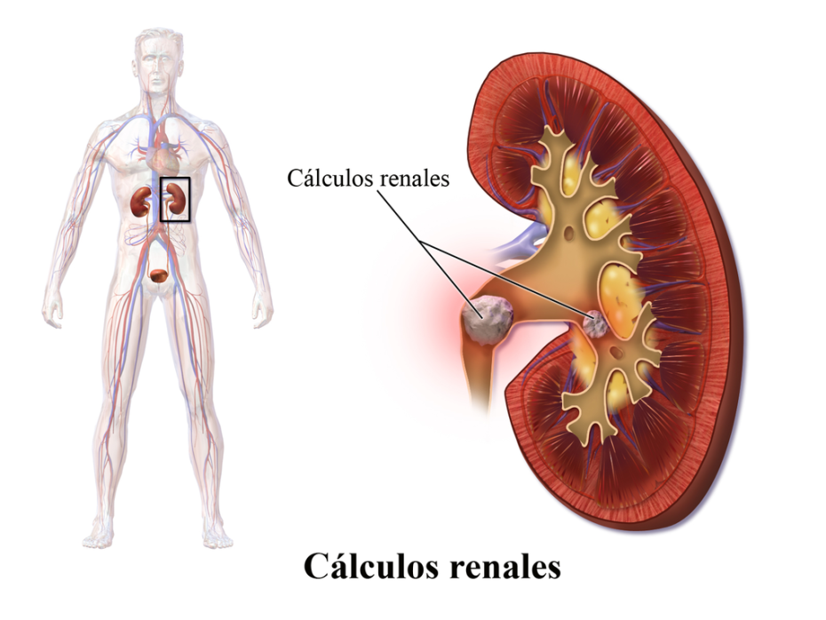 Poleo menta para el dolor de barriga